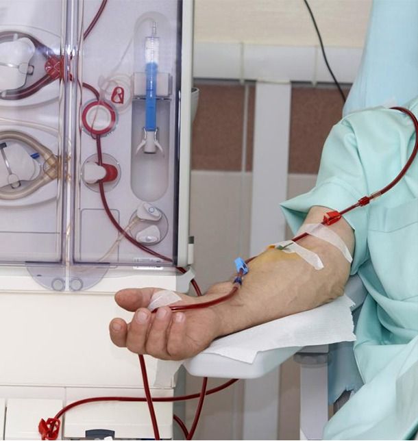 Dialysis